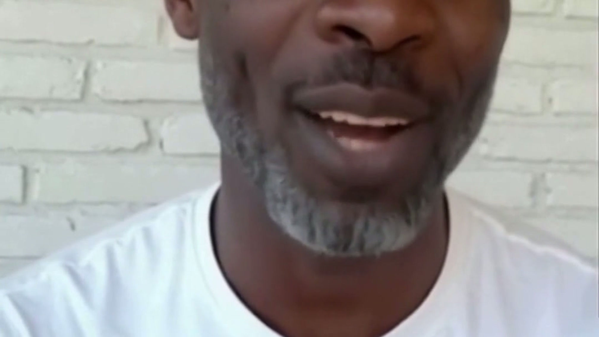 Mexico dental Implants Testimonial